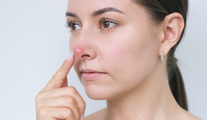画像：鼻を気にしている女性の画像
