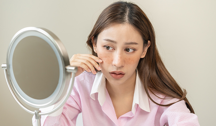 画像：鏡でニキビ跡をチェックする女性