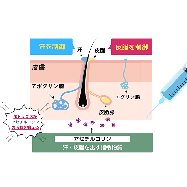 画像：マイクロボトックス施術画像