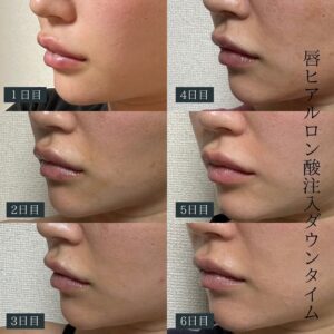 ダウンロード-1
