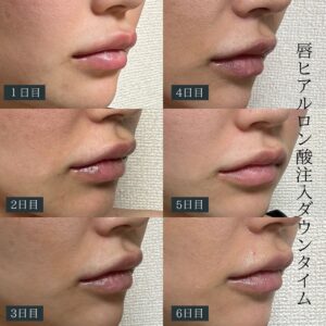 ダウンロード