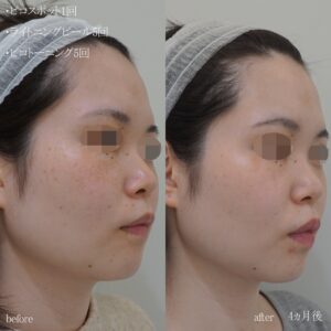 line_oa_chat_221121_125747