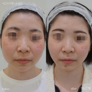 line_oa_chat_221121_125726