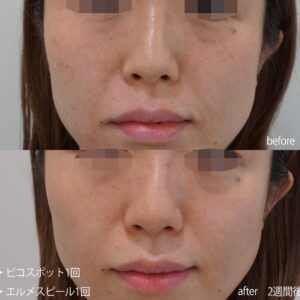 line_oa_chat_221121_125826