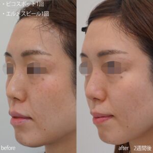 line_oa_chat_221121_125833