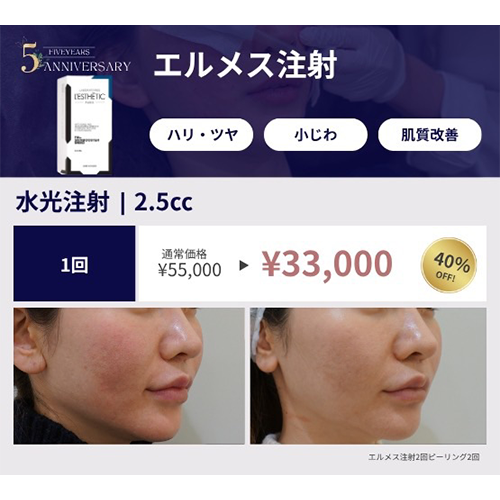 プロモーション内容