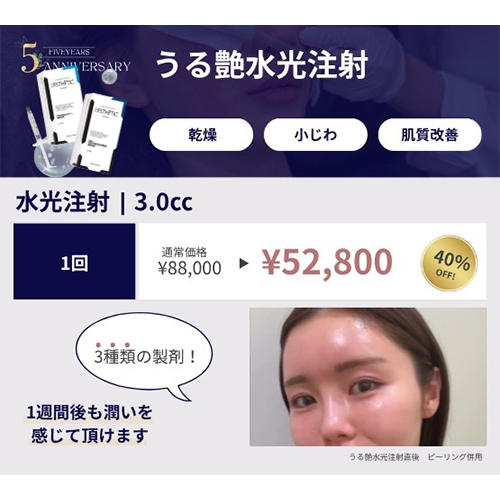 プロモーション内容