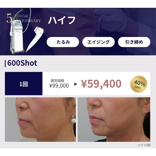 プロモーション内容