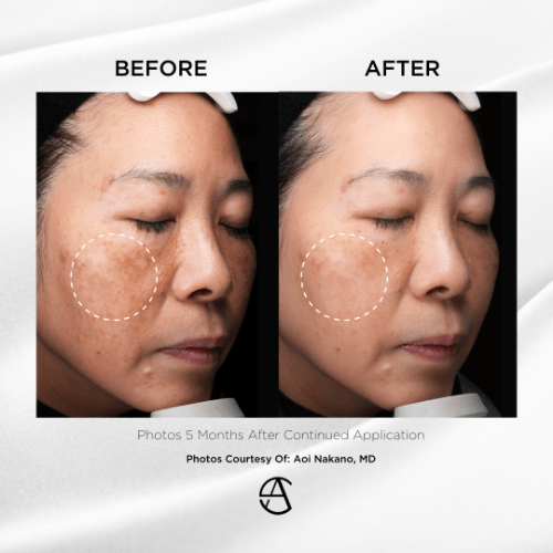 Merabright-case-2-min