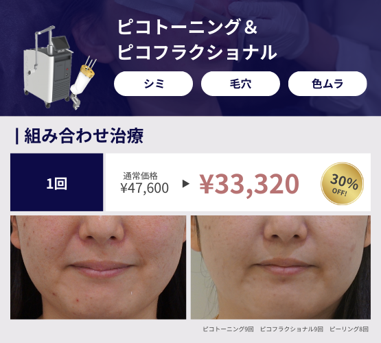 2026年キャンペーン「ピコトーニング＆ピコフラクショナル」