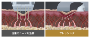 eb8faffde908070dfd28c8c879a51f69-1024x436-1