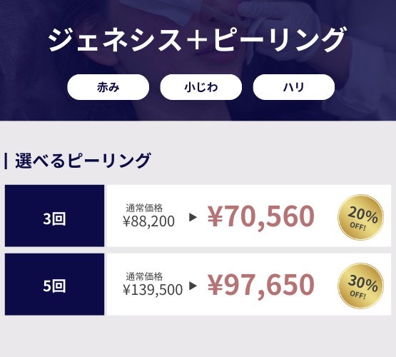 プロモーション内容