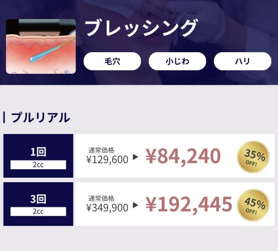 プロモーション内容