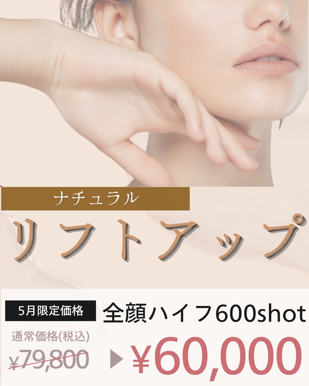 プロモーション内容