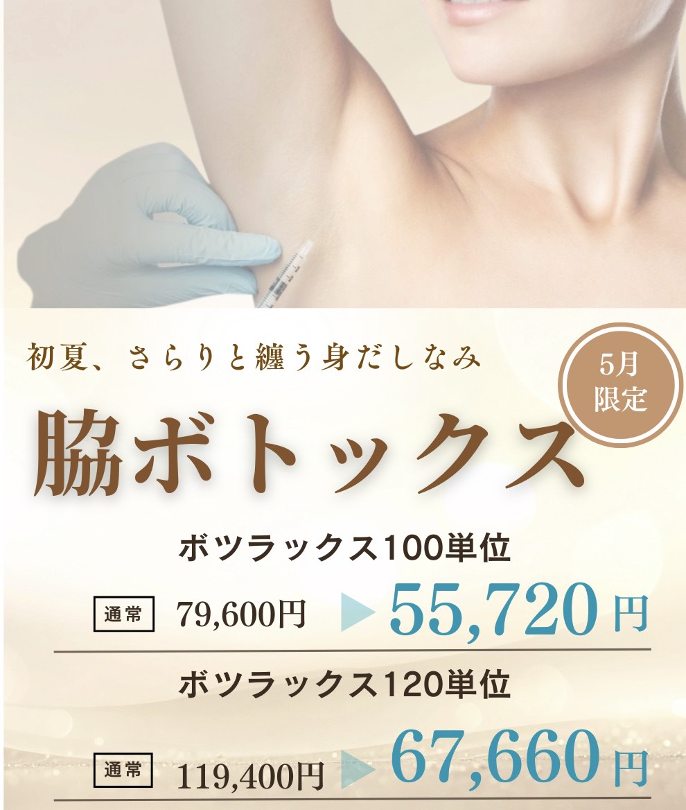 プロモーション内容